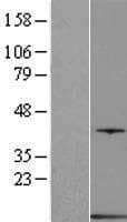 PVALB / Parvalbumin Protein (Over-Expression Lysate Myc-DDK (Flag))