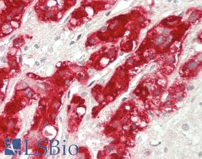 IHC-plus™ SCG3 / Secretogranin 3 Antibody