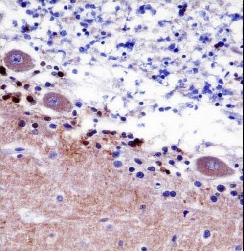 SEPT5 / Septin 5 Antibody (aa1-30)