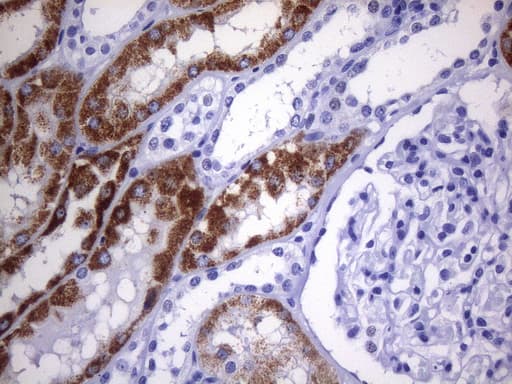 AMACR / P504S Antibody (clone UMAB214)