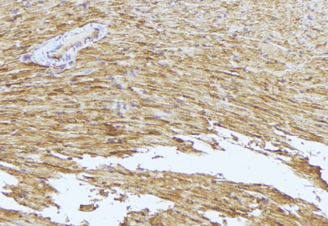 CDC42BPG Antibody