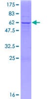 Human CA6 / Carbonic Anhydrase 6 Protein (Recombinant GST)