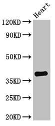 TNMD / Tenomodulin Antibody