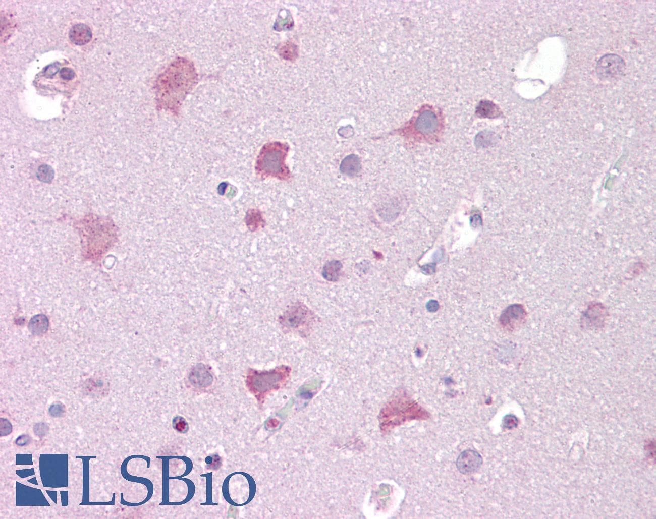 IHC-plus™ Polyclonal Rabbit anti-Human TRPM7 Antibody (aa1821-1850, IHC, WB)