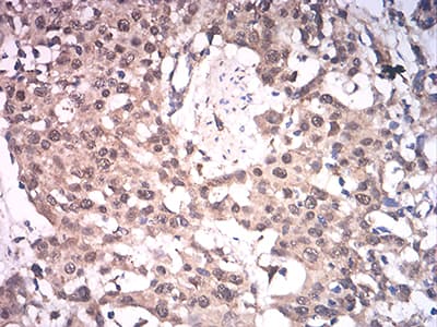 Monoclonal Mouse anti-Human ASH2L / ASH2 Antibody (clone 6B10H10, IHC, WB)
