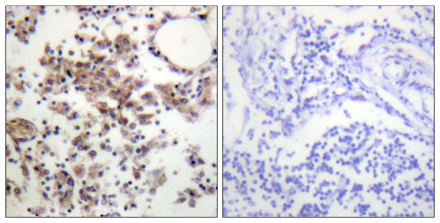 Polyclonal Rabbit anti-Human SYK Antibody (phospho-Tyr323, IHC, IF, WB)