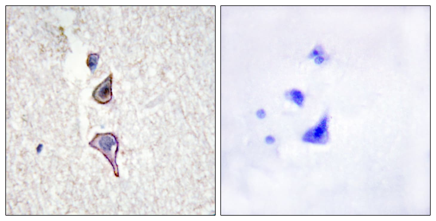 MRC2 / Endo180 Antibody (aa121-170)