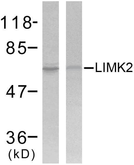 Polyclonal Rabbit anti-Human LIMK2 Antibody (p505, WB)