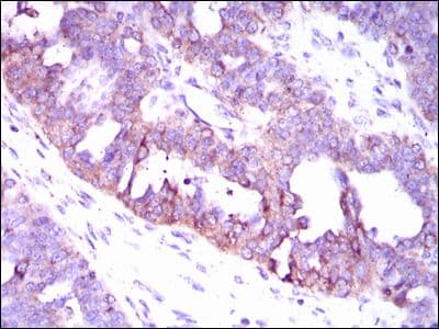 CAMK4 / CaMK IV Antibody (Amino Acid: 35-292, clone 8C5B8)