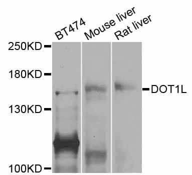 DOT1L / DOT1 Antibody