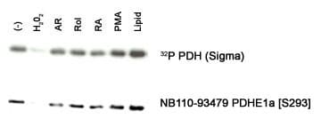 PDHA1 / PDH E1 Alpha Antibody (phospho-Ser293)