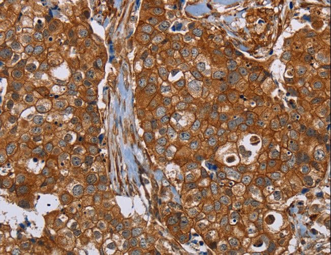 PLEC / Plectin Antibody