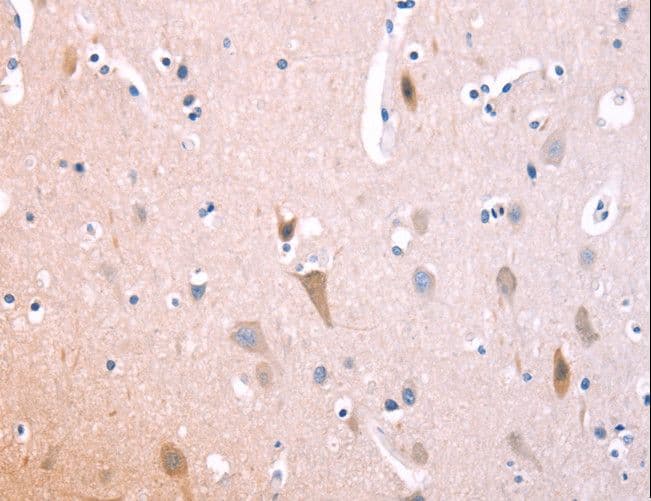 IL1RL1 Antibody