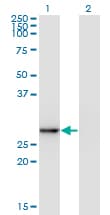 EXOSC5 Antibody (clone 1E11)