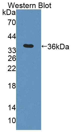 ACAA2 Antibody (Biotin)