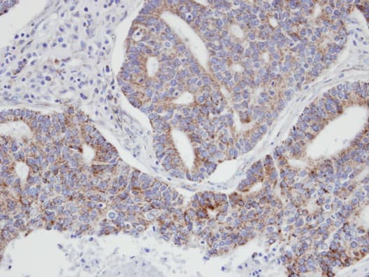 p21-ARC / ARPC3 Antibody (aa1-178)