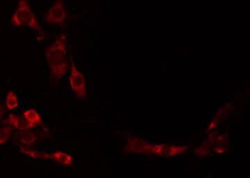 CHST1 Antibody