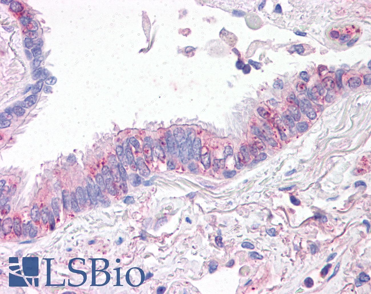 IHC-plus™ SLC31A1 / CTR1 Antibody (Internal)