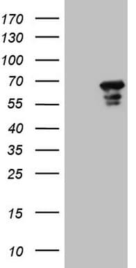 MEF2D Antibody (aa1-282, clone OTI10B4)