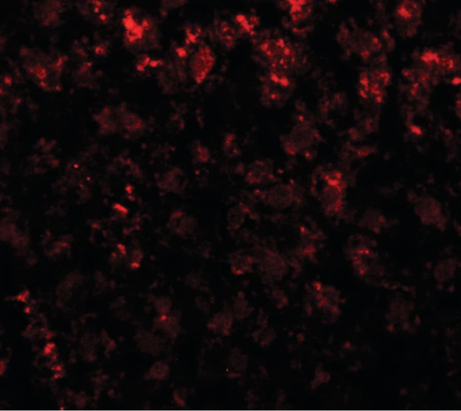 Polyclonal Rabbit anti-Human Alpha-Fetoprotein Antibody (IHC, IF, WB)