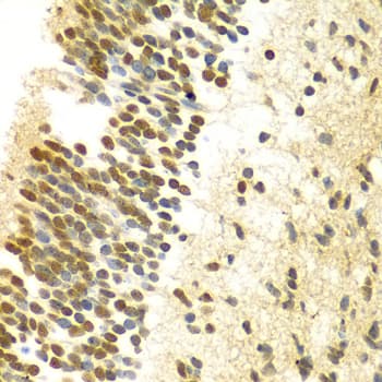 MYSM1 Antibody