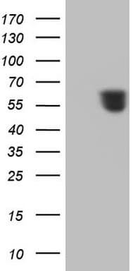 RARA / RAR Alpha Antibody (aa52-299, clone OTI2B4)