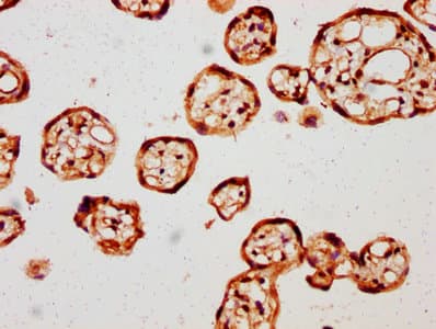 AMOT / Angiomotin Antibody (aa1-300)