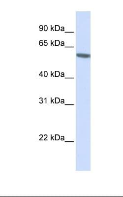 Polyclonal Rabbit anti-Human FKBP5 / FKBP51 Antibody (aa326-375, IHC, WB)