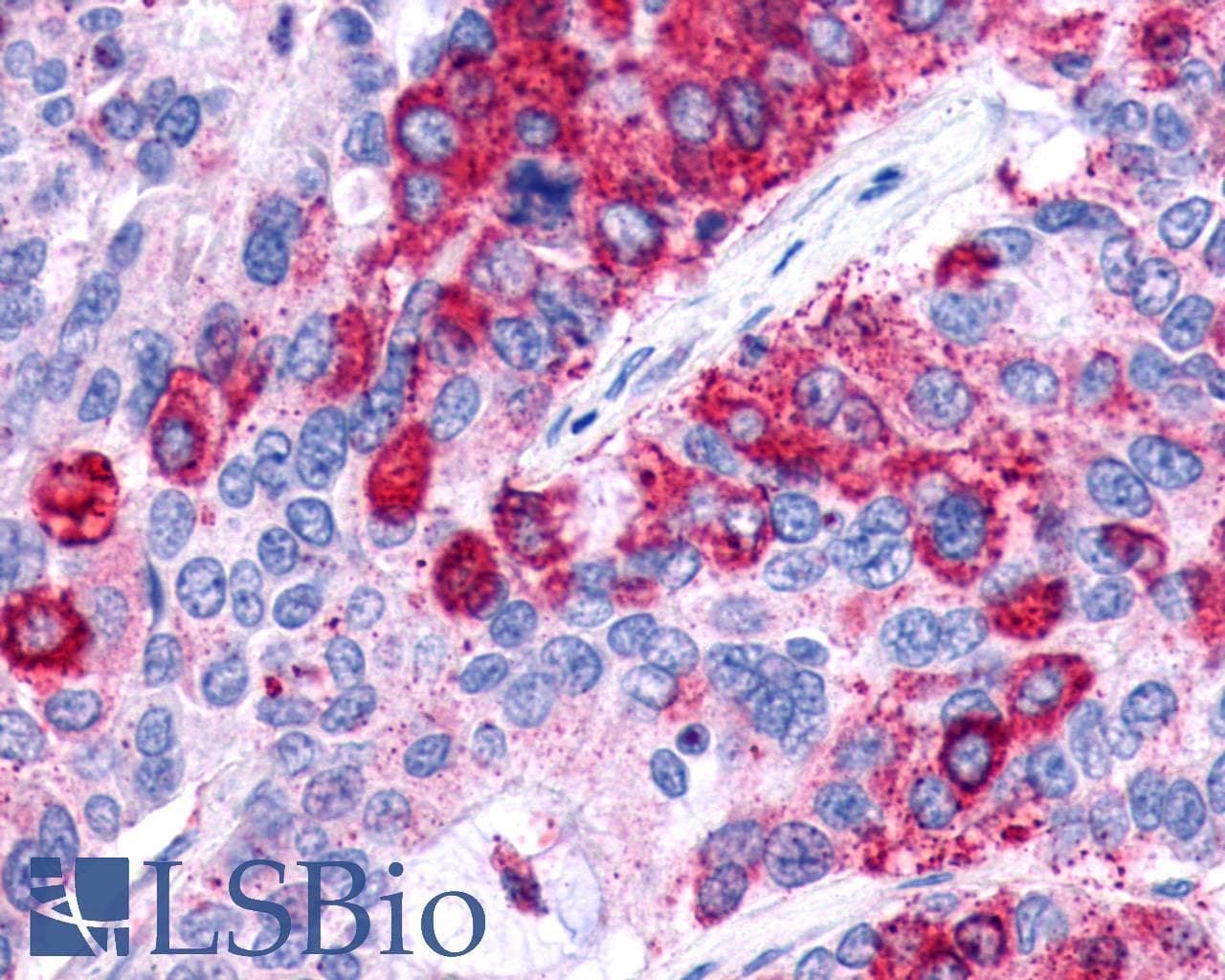 PathPlus™ GPR48 / LGR4 Antibody (N-Terminus)