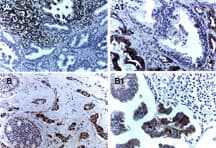 BIRC5 / Survivin Antibody