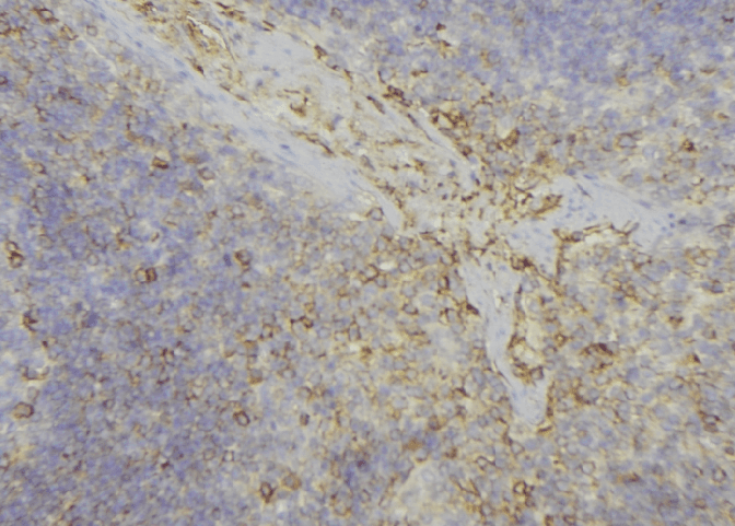 ADH6 Antibody