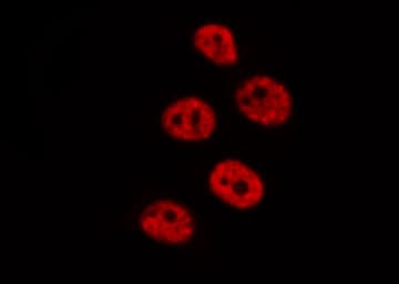 DUSP4 / MKP2 Antibody