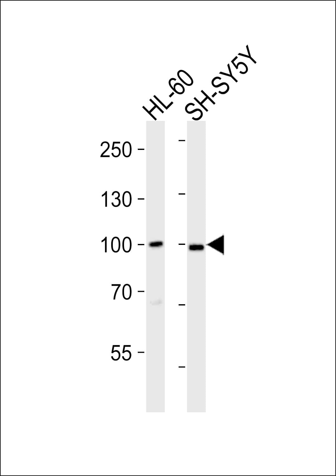 Polyclonal Rabbit anti-Human MAP3K12 Antibody (aa828-859, IHC, WB)