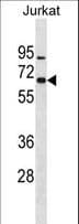 Polyclonal Rabbit anti-Human ZNF358 / ZFEND1 Antibody (aa43-69, WB)
