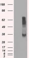 RNF144B Antibody (clone OTI3C2)