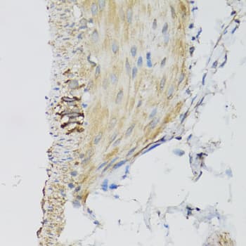 DGUOK / Deoxyguanosine Kinase Antibody