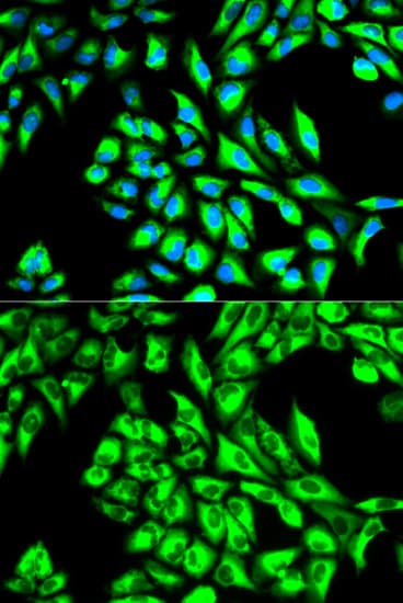IHC-plus™ Polyclonal Rabbit anti-Human EEF1A1 Antibody (IHC, IF, WB)