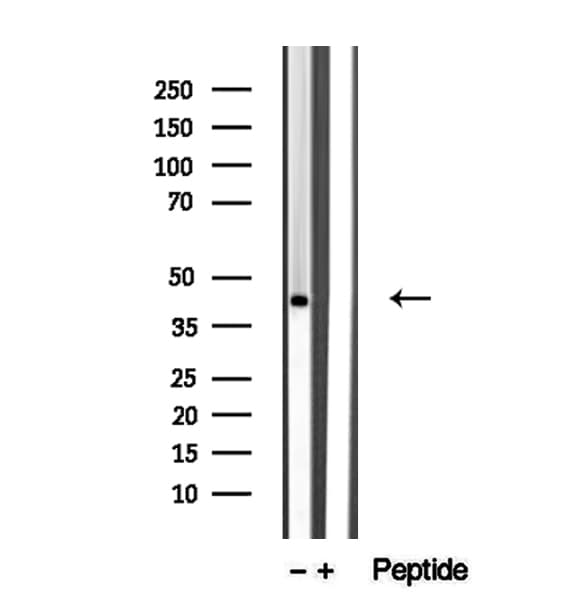Polyclonal Rabbit anti-Human TMOD1 / Tropomodulin 1 Antibody (IHC, IF, WB)