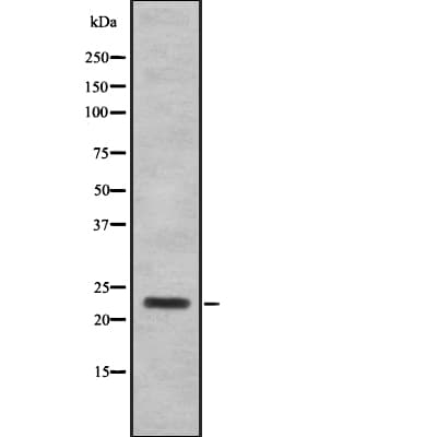 SAP30 Antibody