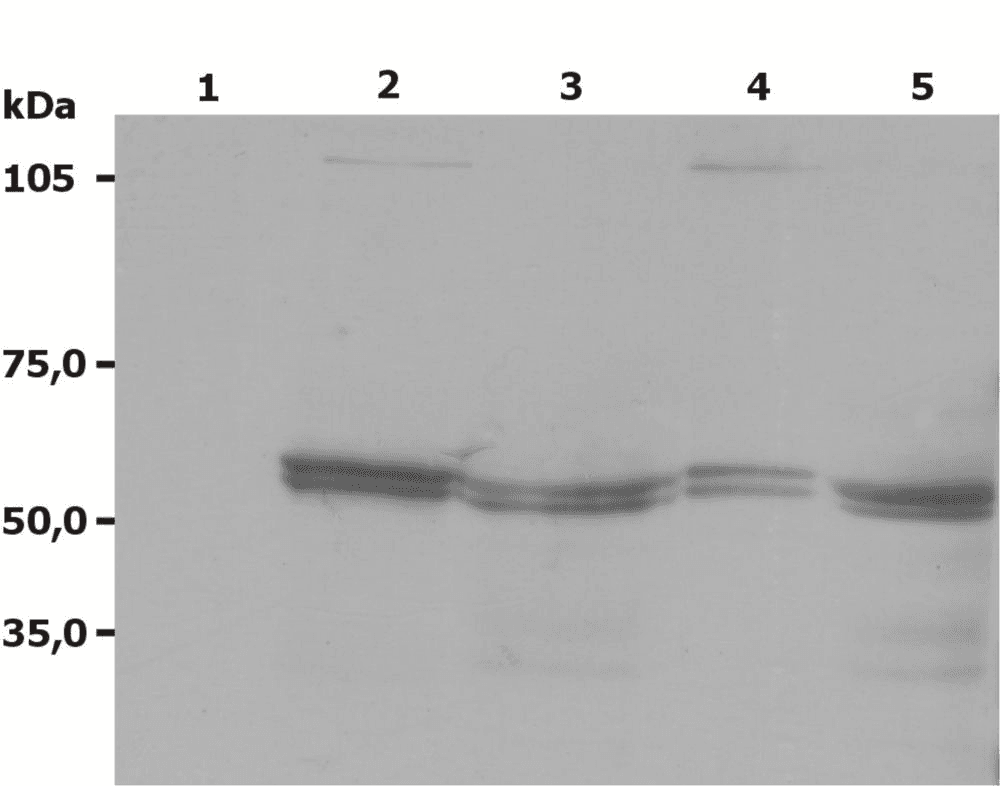 LYN Antibody (aa8-238, clone LYN-01)