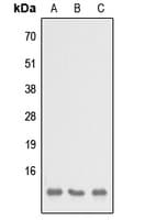 Polyclonal Rabbit anti-Human SH3BGRL3 Antibody (Internal, WB)