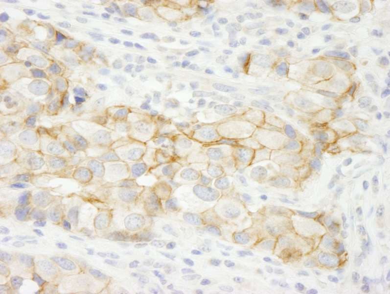 KIAA0528 Antibody (aa375-425)