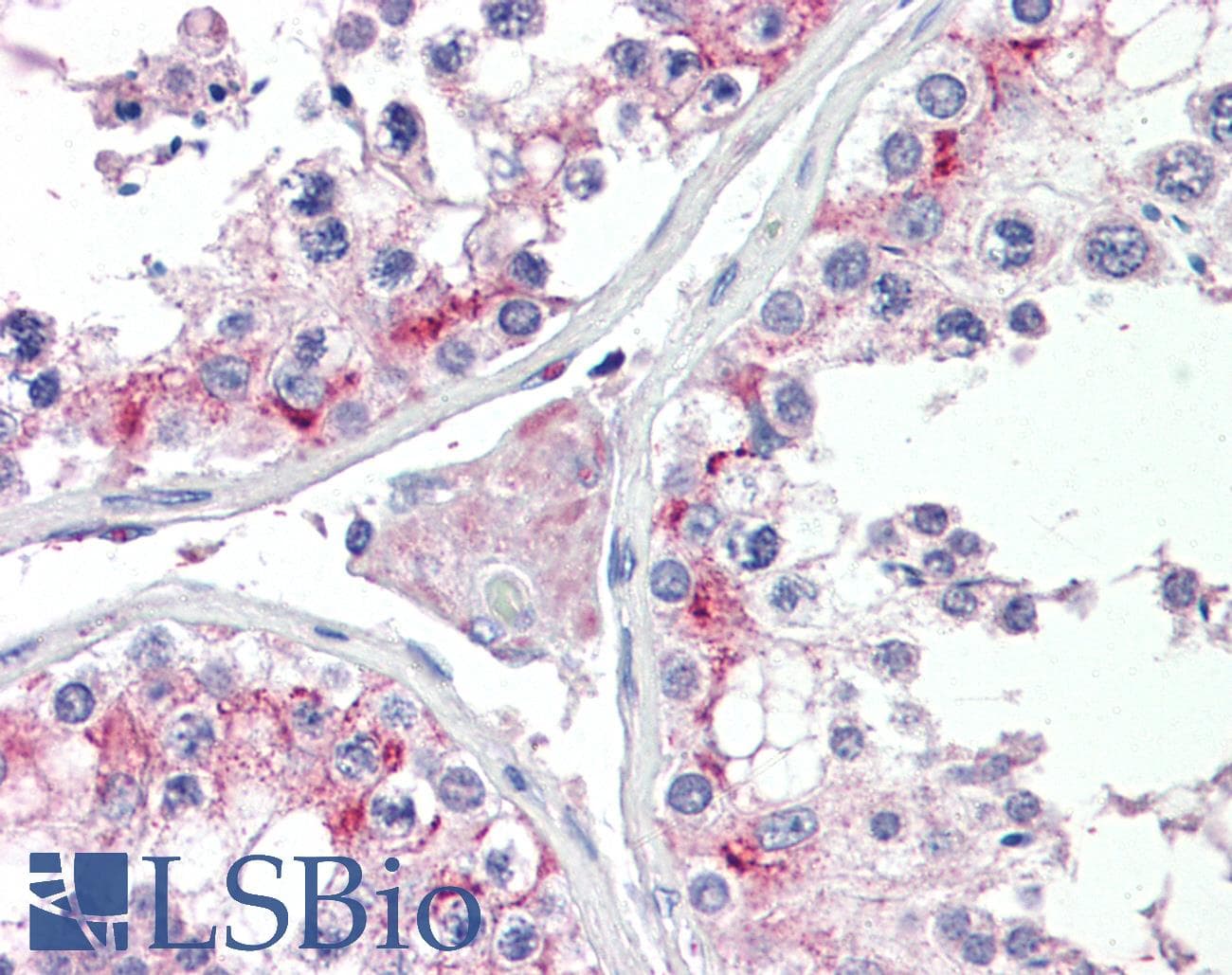 IHC-plus™ ZDHHC17 Antibody (aa621-632)