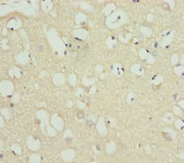 Polyclonal Rabbit anti-Human ACSL6 Antibody (IHC, WB)