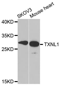 TRP32 / TXNL1 Antibody