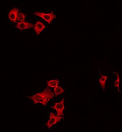 Polyclonal Rabbit anti-Human GBTS1 / DIRAS1 Antibody (IF, WB)