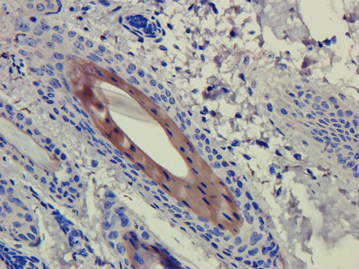 CD4 Antibody (CD4, clone CE9.1 (Clenoliximab))