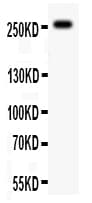 ABCA4 Antibody (aa1892-1903)