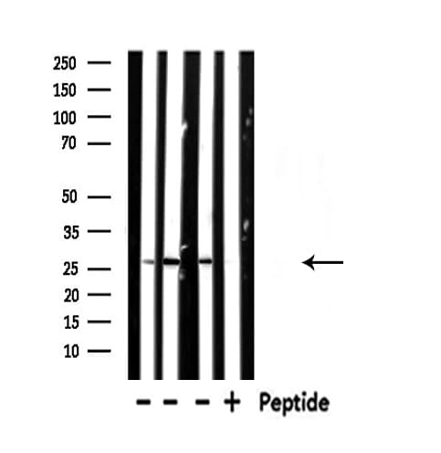 Polyclonal Rabbit anti-Human NDUFV2 Antibody (IF, WB)