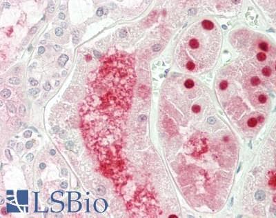 IHC-plus™ ABCC10 Antibody (aa835-884)
